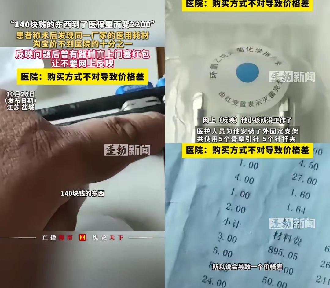 刷医保的糊涂账，这次真的忍不了！
江苏盐城的黄先生，骨折手术后发现耗材价格淘宝只