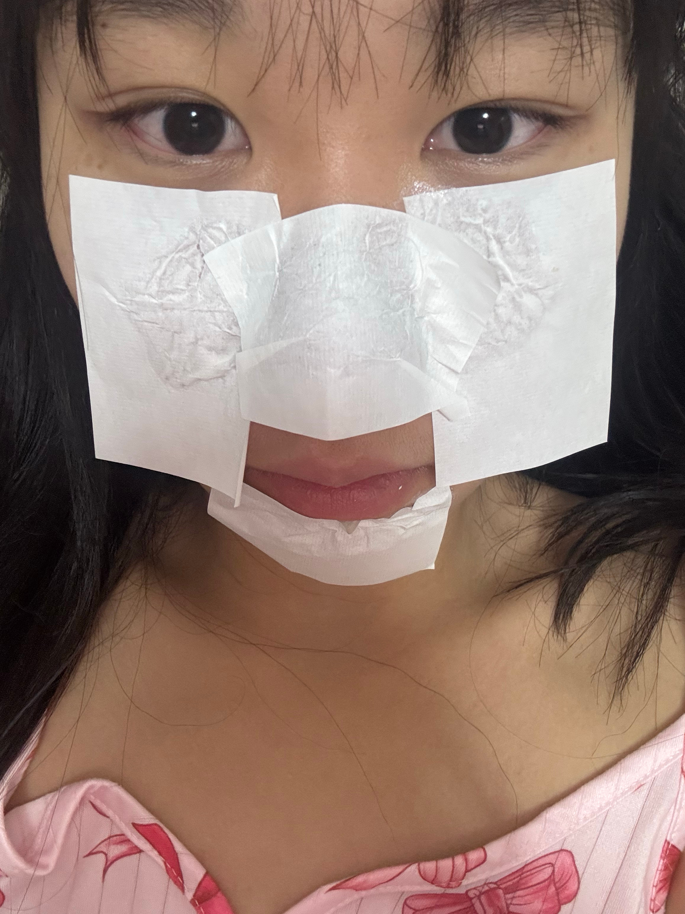 这个去黑头的好好用啊 ​​​