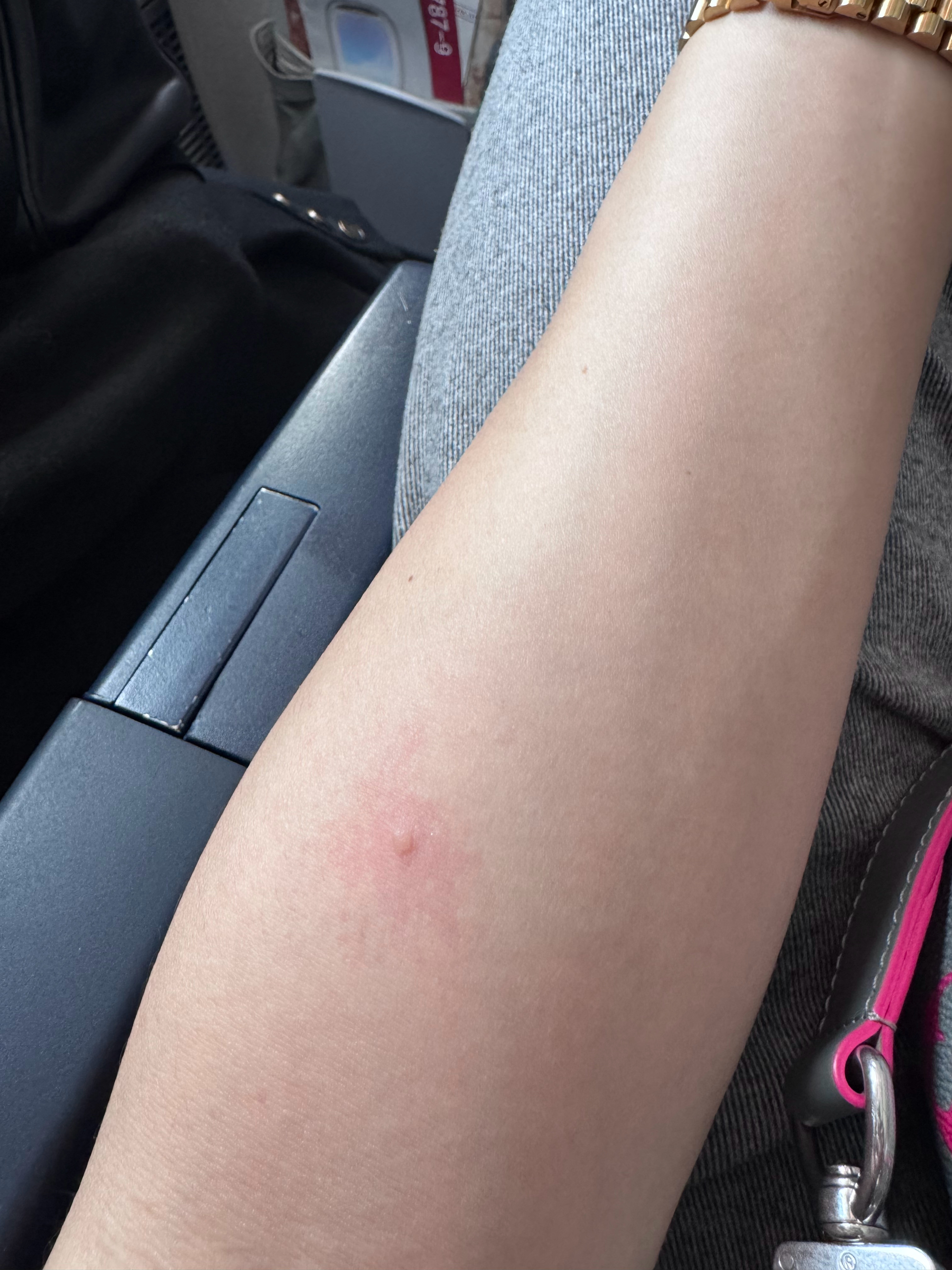 烫了个泡，猜猜咋弄的？