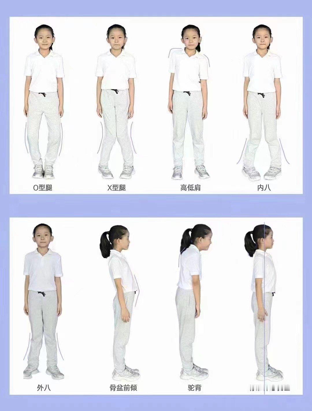 #中医##育儿专家说# 家长朋友们快快来自测一下孩子的体态是否在正常范围  ​​