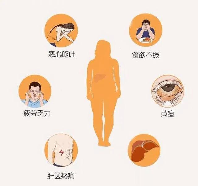 肝病都是拖出来的，出现这7个信号要警惕1. 疲惫乏力乏力是肝病早期的常见表现，因