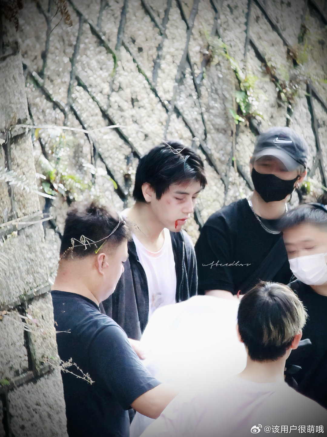 陈飞宇殴打妆不像化的 新鲜出炉的陈飞宇也太让人心疼了！这殴打妆也太真实了，伤痕细