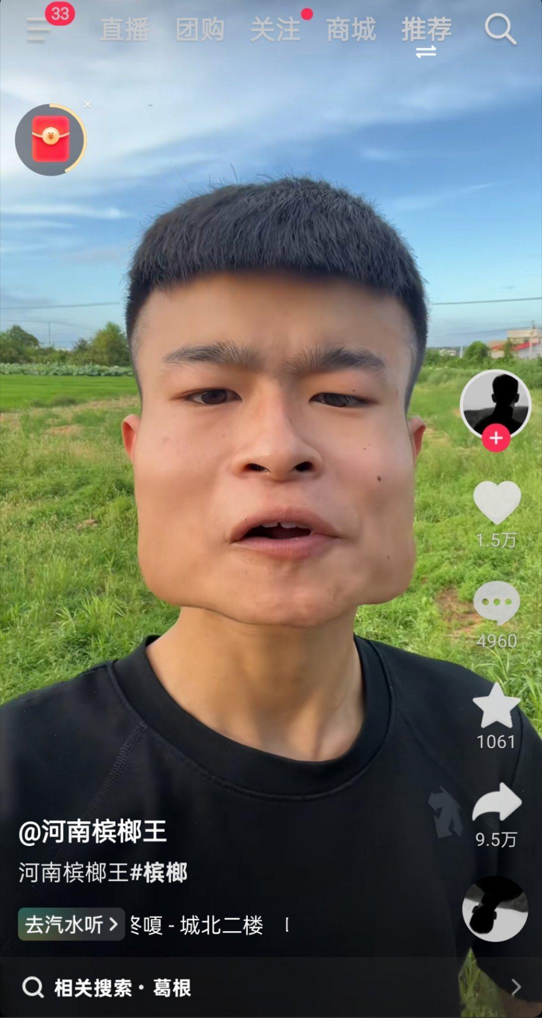 是个狠人，脸都成这样了还吃槟榔[柯基] ​​​