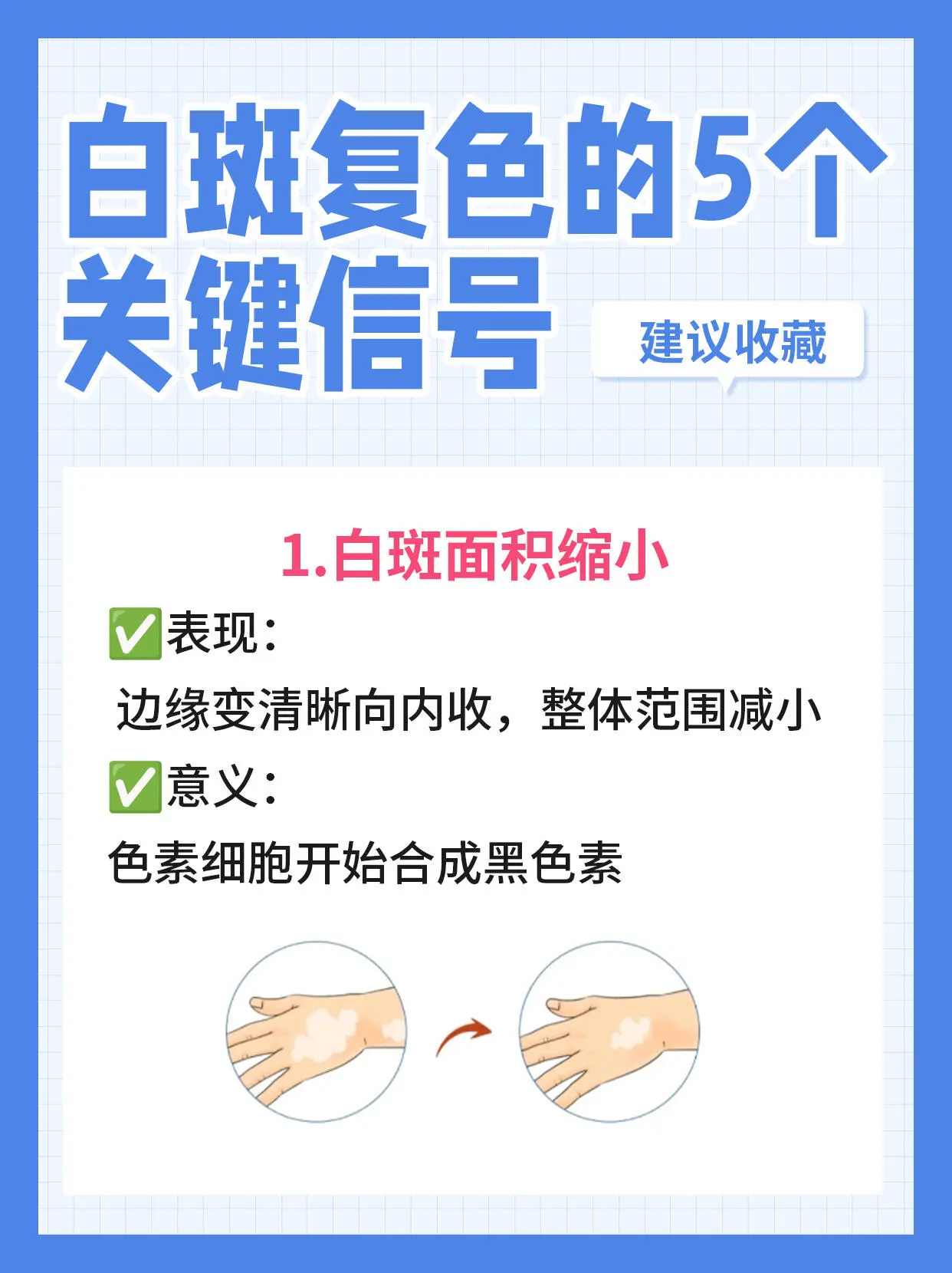 白癜风 白斑 皮肤健康 抖出健康知识宝藏