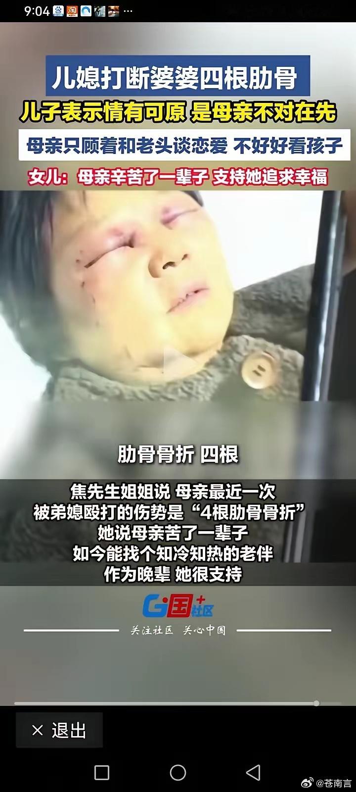 婆婆被儿媳打断肋骨儿子称情有可原这个当儿子的，你媳妇把你的母亲打成了重伤，你还替