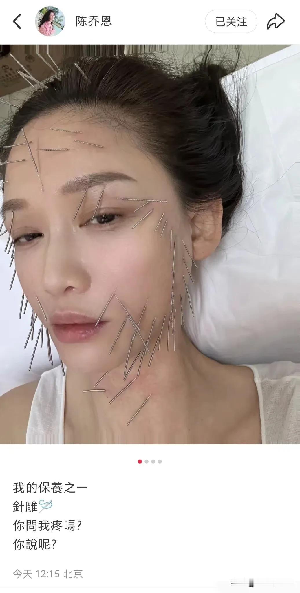 一般人还真做不了明星！看看人家陈乔恩，为了美，做什么针 雕！不仅头、脸，还有脖子