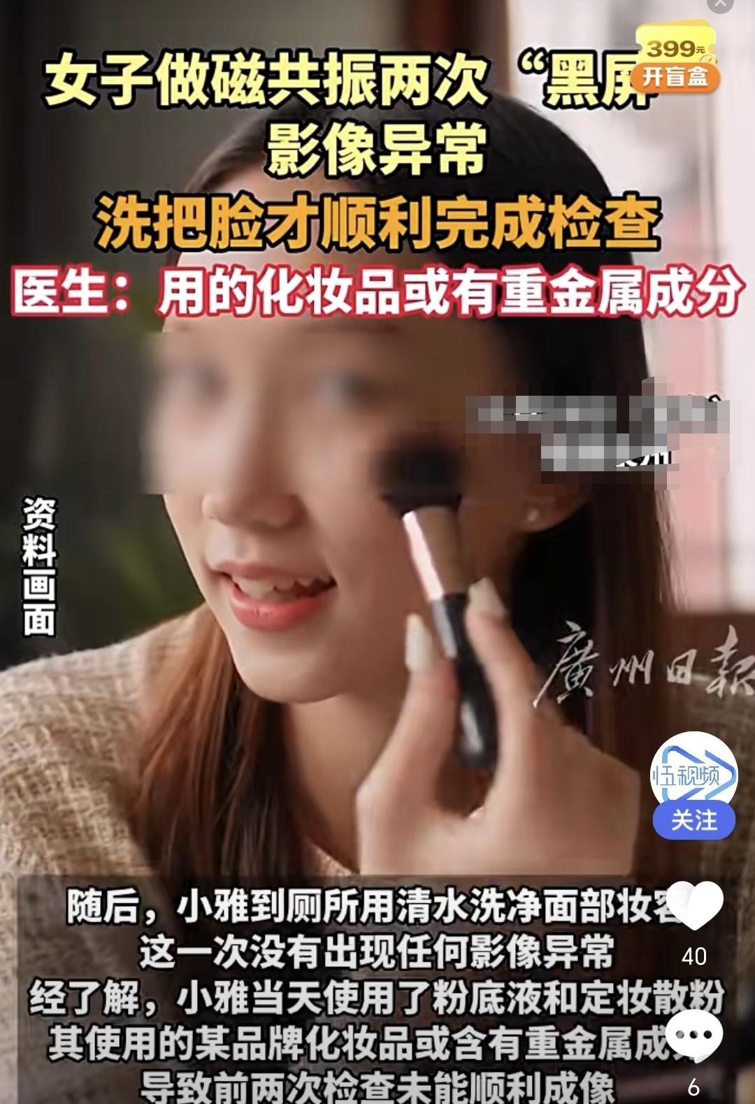 解释不清了！福建一29岁女生头晕，去医院做头颅磁共振。不料，连续2次扫描，都因面