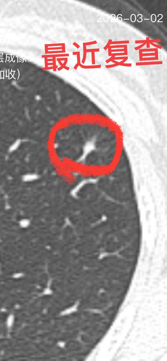 肺部结核治疗7个月了，复查肺部Ct 明显吸收，但仍有一点点病灶未完全恢复，患者目