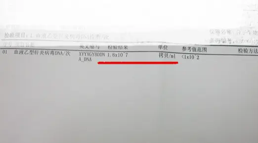 大三阳，乙肝病毒7次方，肝功能正常要不要抗病毒治疗？ 我们不能只依据病...