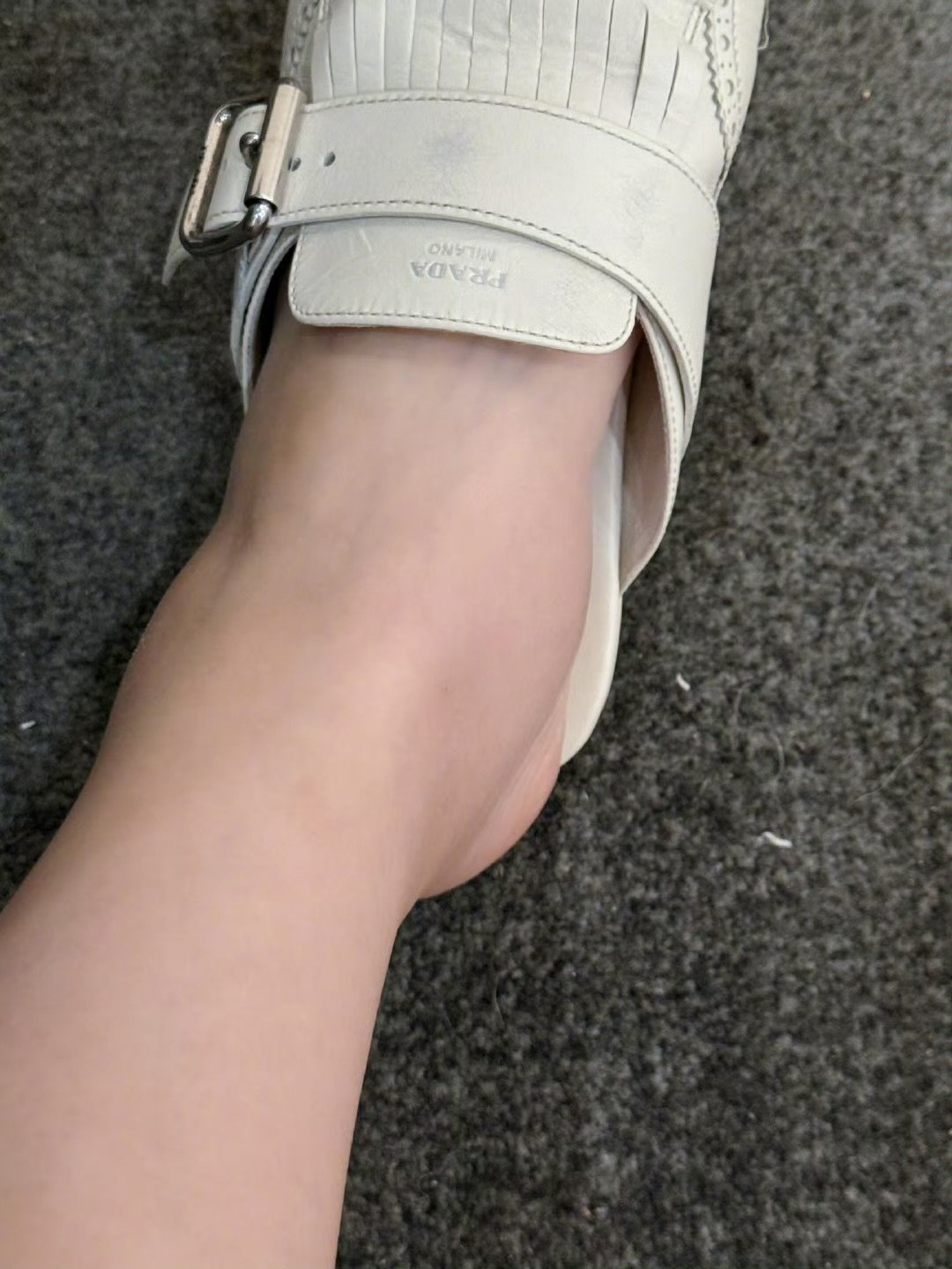 张馨予雨林徒步后的脚肿了张馨予雨林徒步的脚肿成了猪蹄张馨予雨林徒步后的脚肿成了猪