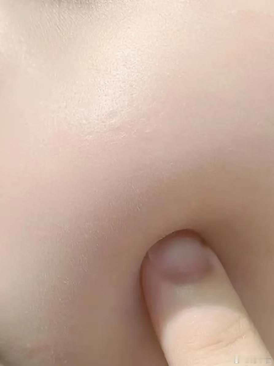 作为成分党+细节控，选项目超谨慎。研究了好久惟她天使，它那个PLLA-b-PEG
