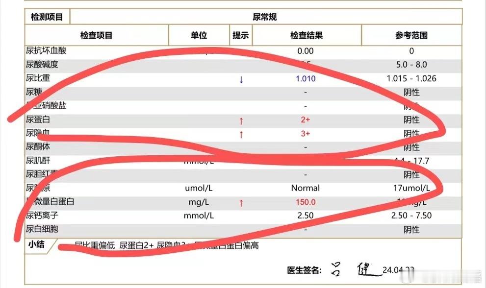 泌尿系统分为上下泌尿系统，上面是肾脏，下面是尿路，女性隐血阳性，先考虑尿路问题，