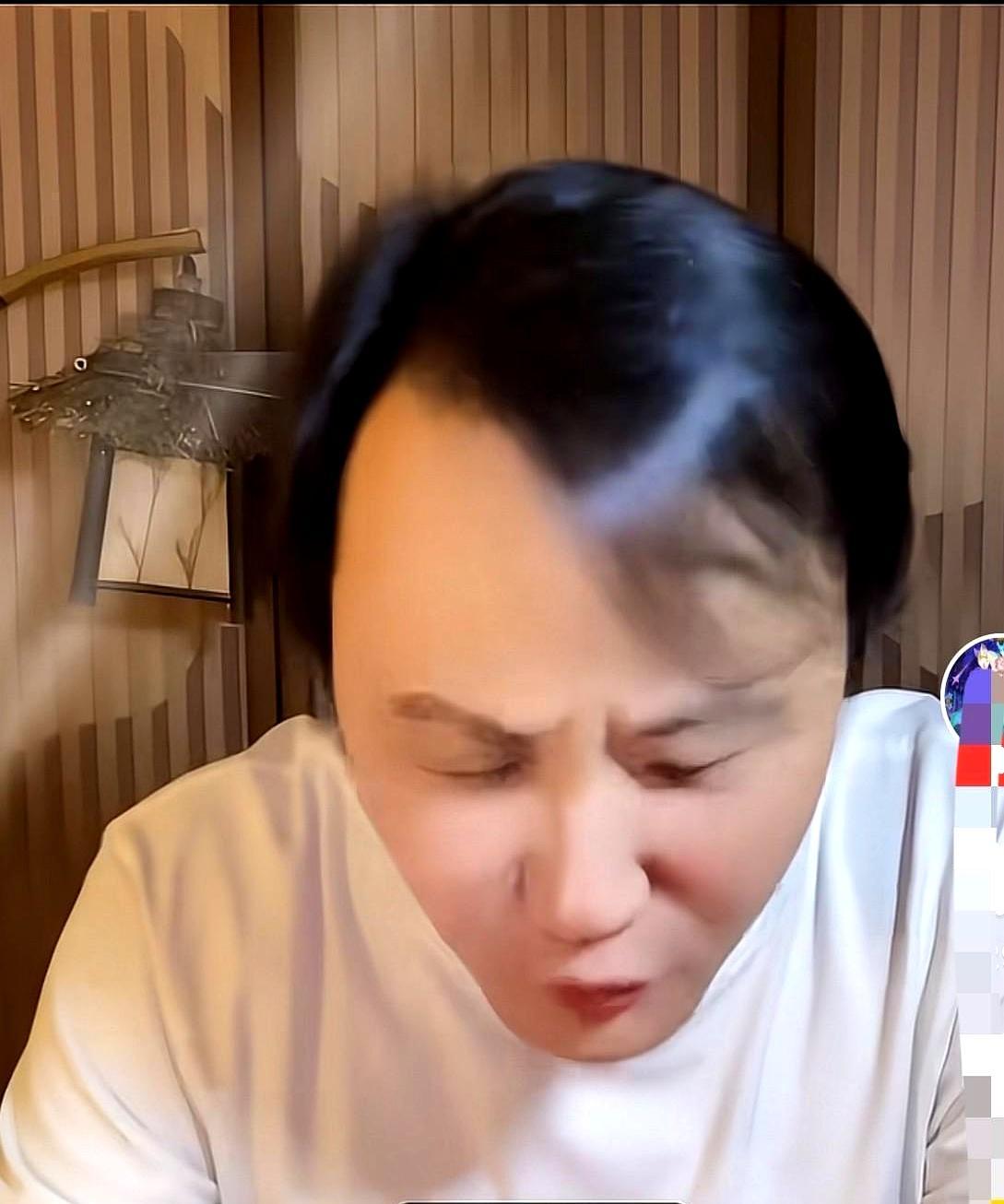 他直播时突然跪地磕烟灰缸，额头青紫还笑：“肠子悔青了！”
 
七年前甩手离开德云