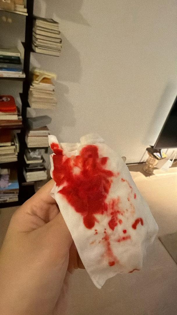 ⚠️感冒咳嗽流鼻血🤒毛细血管太脆扯出鼻子里的纸带出一细条果冻状血块 那一刻精神