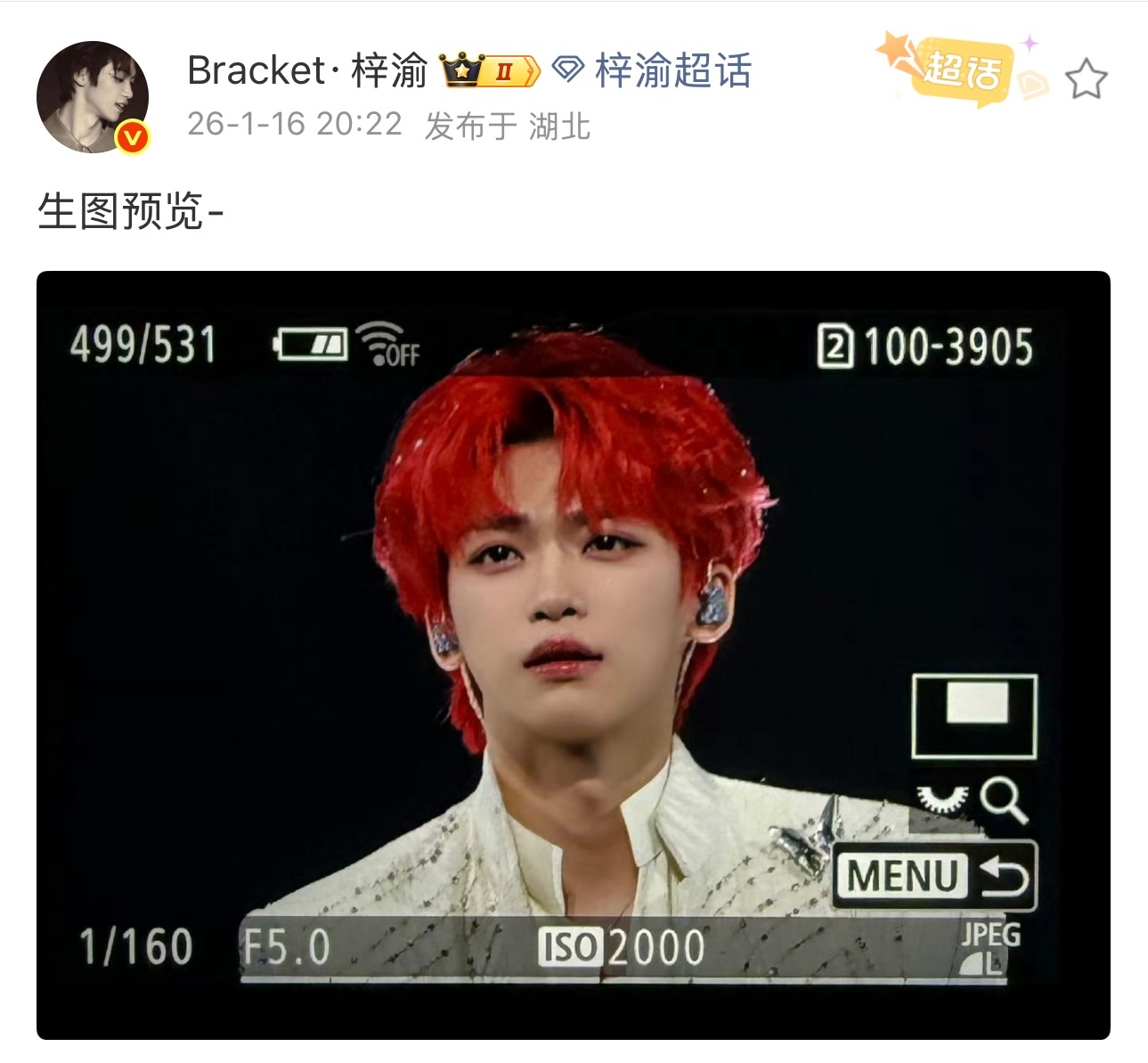 梓渝站姐发了梓渝演唱会生图，这完全就是神颜，生图可直出的水平，怎么会有这样天生丽