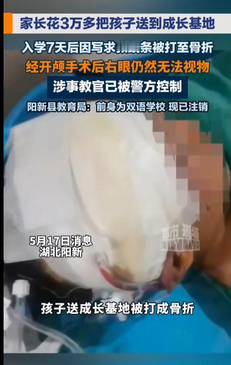 太可怜了！5月17日大众日报报道，江西九江一13岁男生被父母送入“成长基地”接受