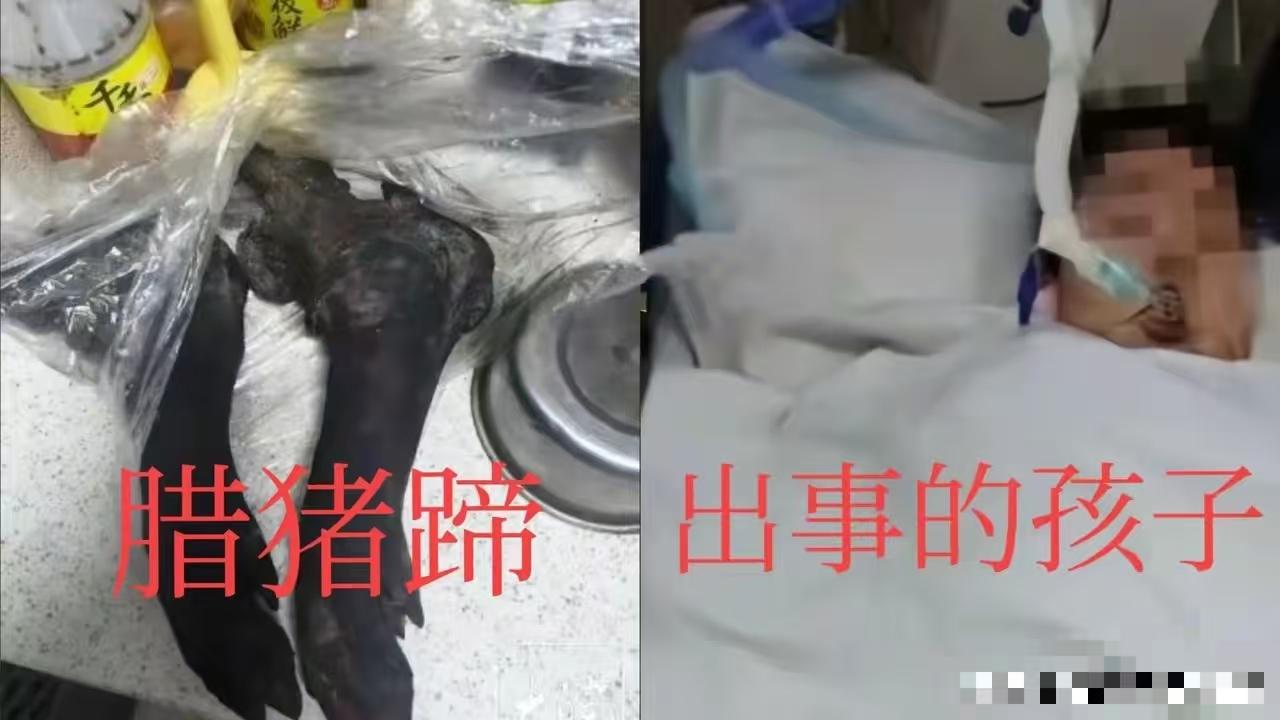 被猪蹄卡喉身亡的10岁男童，本可以避免的！两个原因，孩子以为妈妈给的是肉，不带骨