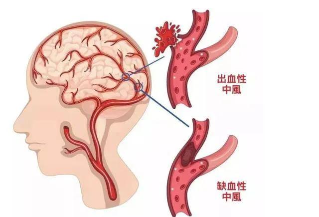 “你觉得，吃氨氯地平真的会出事吗？”小张问她的同事，眼神里满是疑惑。小李放下手里