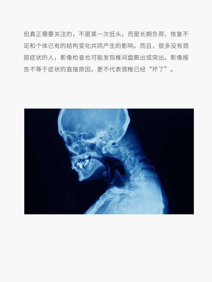 肩颈酸痛 久坐低头族的颈椎病，根源不只是“低头”——脖子酸、肩胛骨旁边痛，再看到