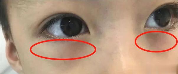 能吃不长个不长肉？有可能是脾强胃弱，1次纠正过来！
 
门诊上脾胃不好的孩子一抓