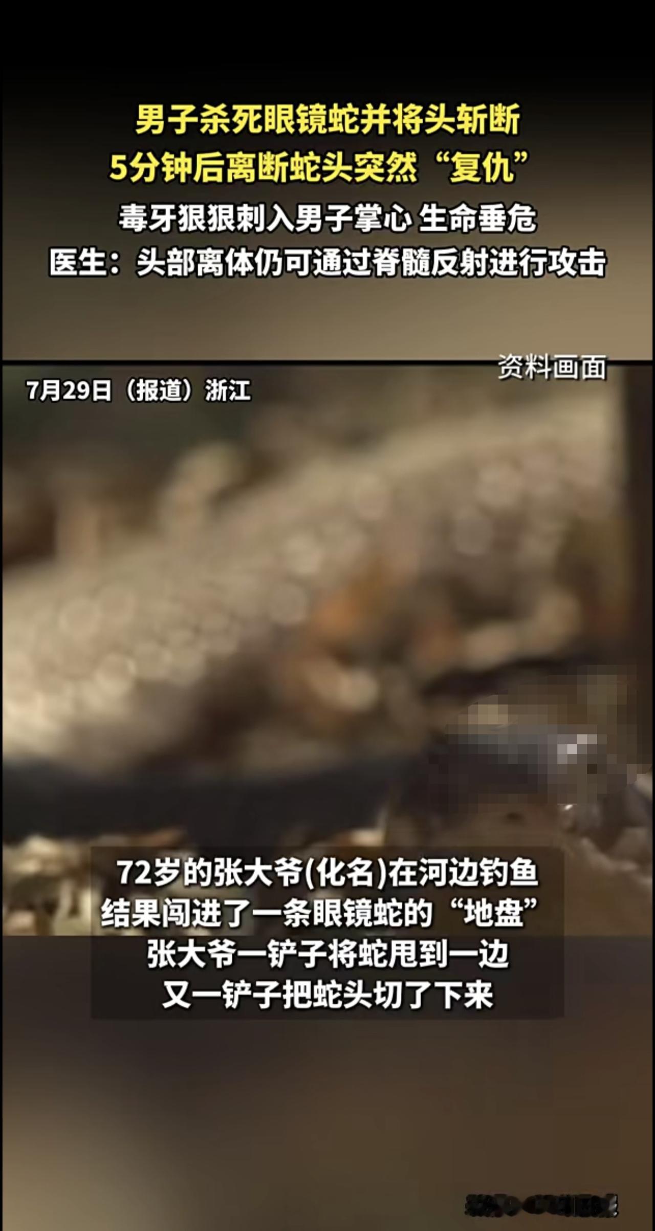 浙江72岁大爷杀死剧毒眼镜蛇，5分钟后离断蛇头突然“复仇”，毒牙狠狠刺入其掌心，