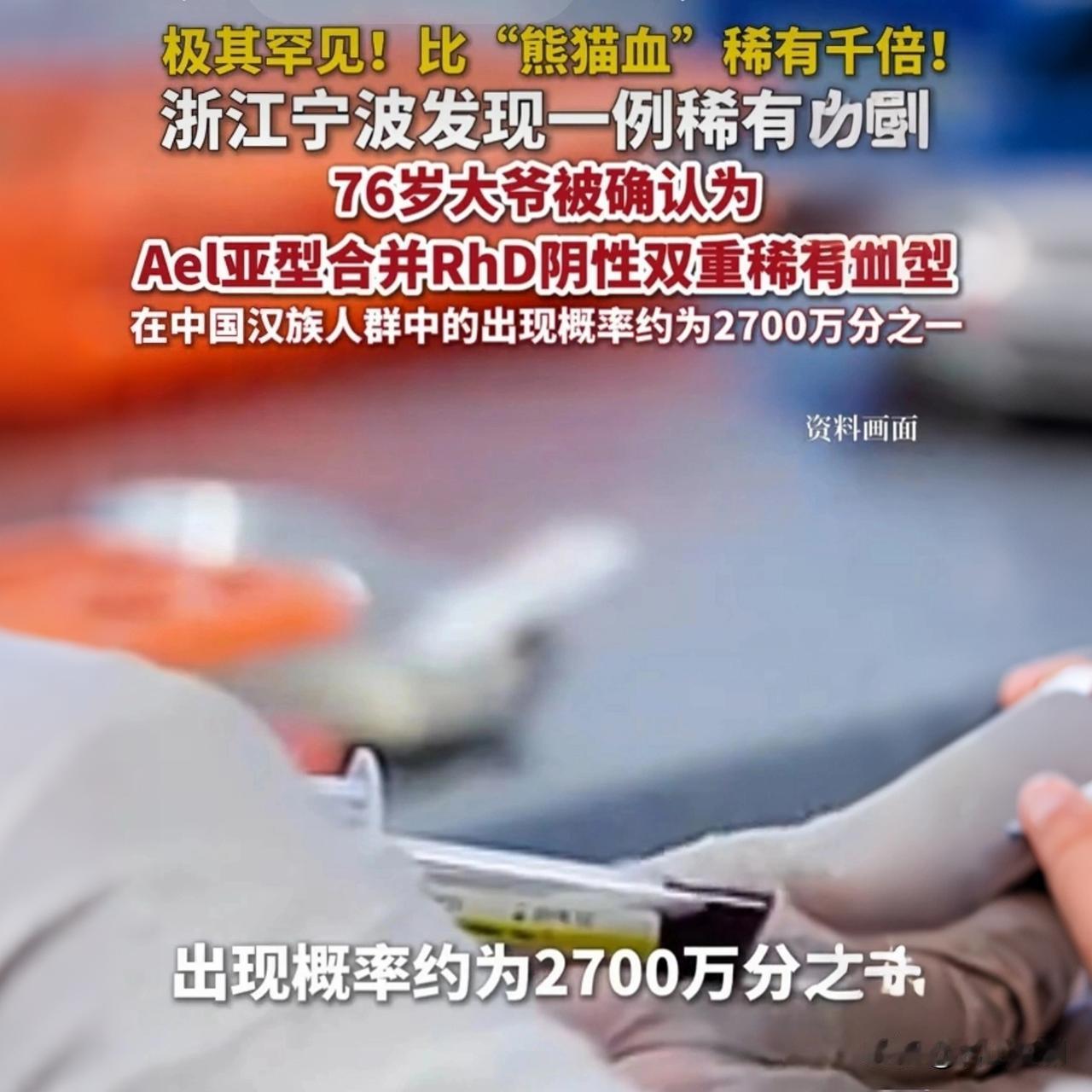 宁波76岁大爷车祸，一检查，竟查出“1/27000000”的超级稀有血型！比“熊