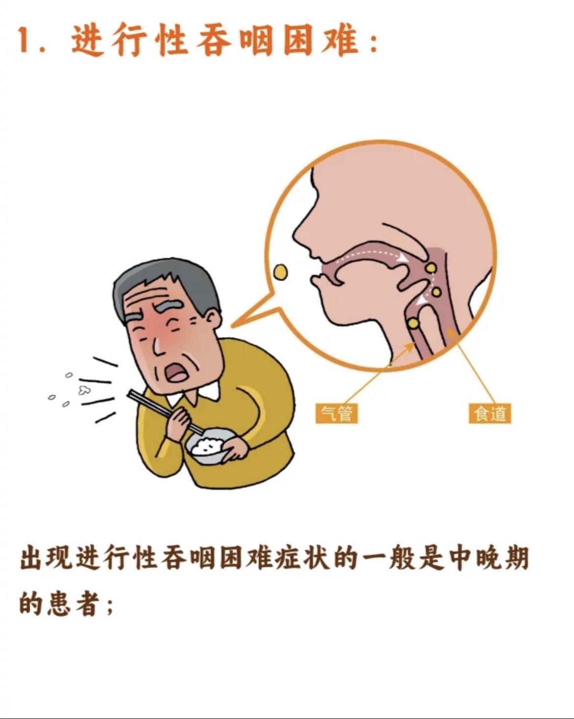 食管癌常见的6大症状。