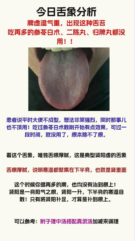 今日舌象