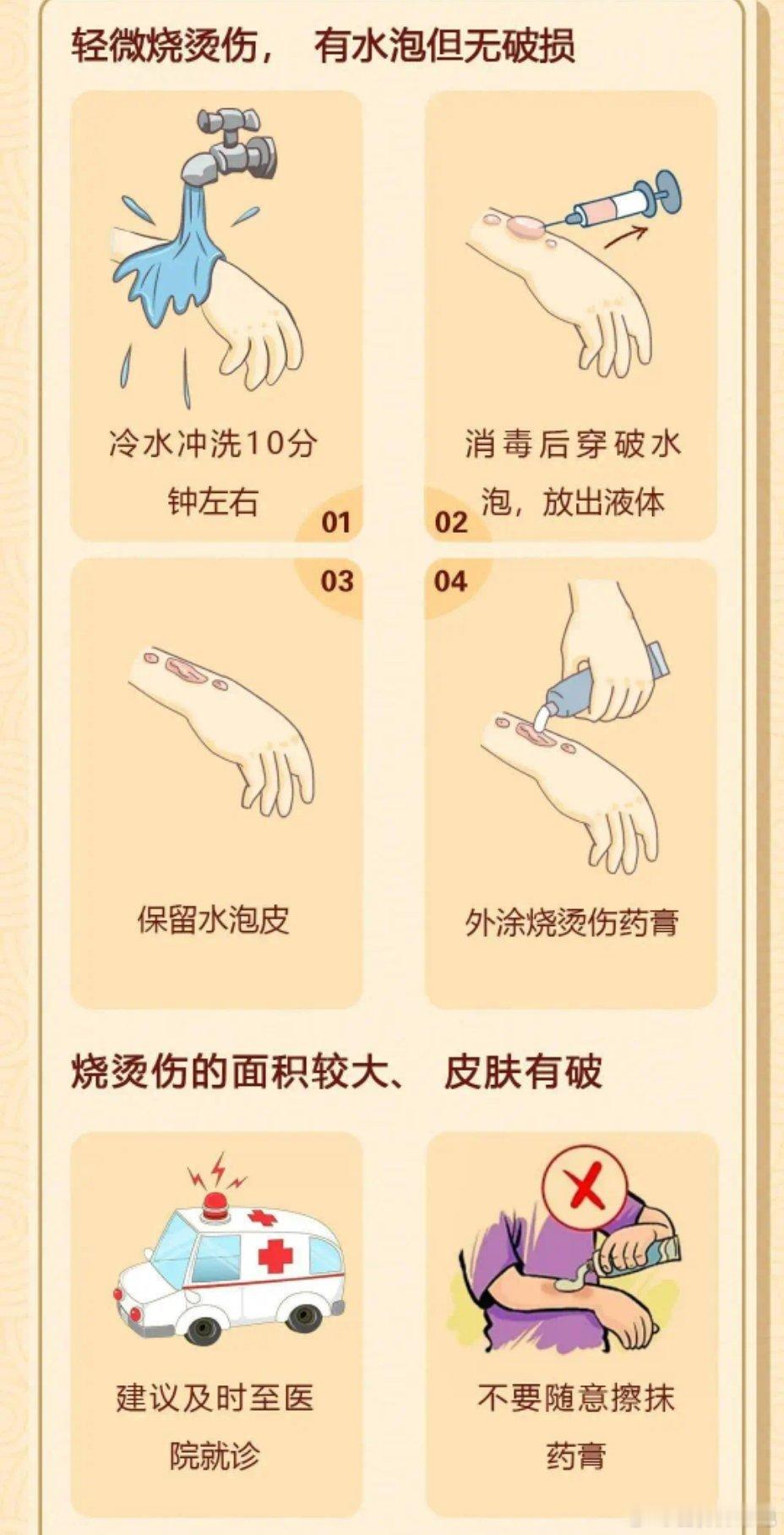 烟花炸伤烧伤如何自救  把健康带回家  烧烫伤急救5步: 冲、脱、泡、盖、送冲: