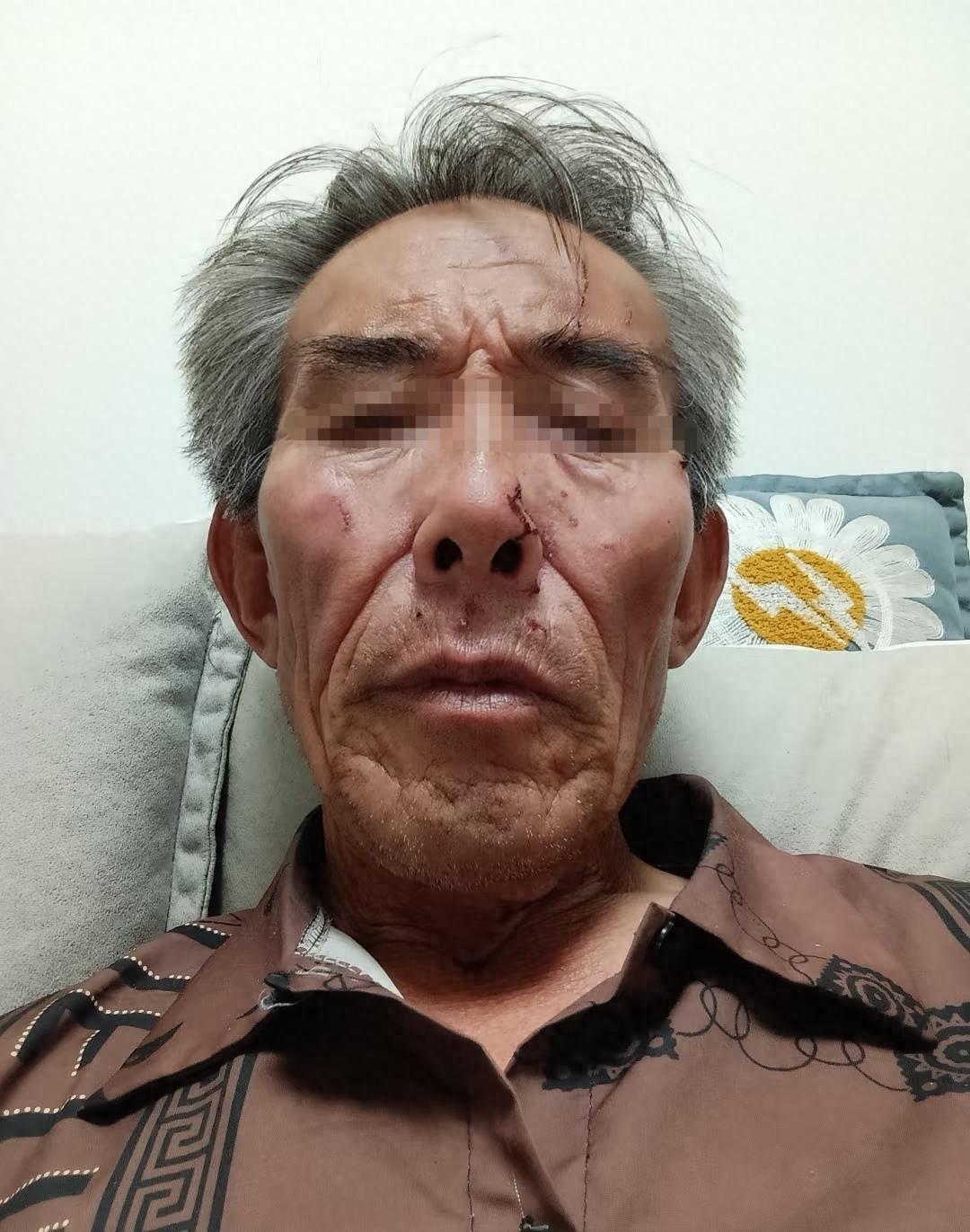 好心劝阻被围殴？内蒙古一名保洁员劝阻游客不要乱扔烟雾棒，要求将废弃烟雾棒扔进垃圾