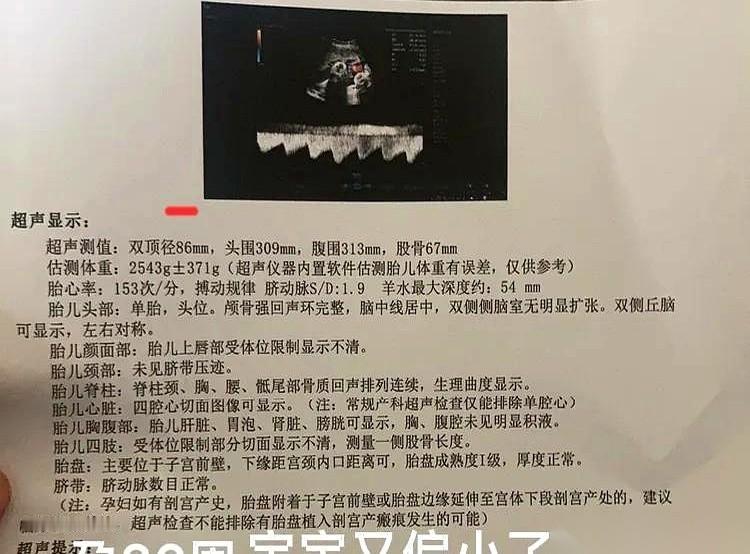 B超探头刚从肚子上拿开，医生那句话就砸了过来：“宝宝偏小，比上次还严重。”
整整