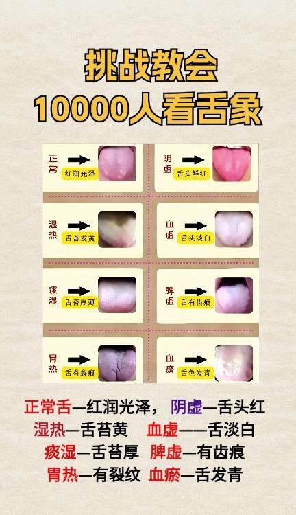 身体好不好，看舌苔就知道！
挑战教会10000人看舌象！
#调理身体 #中医 #