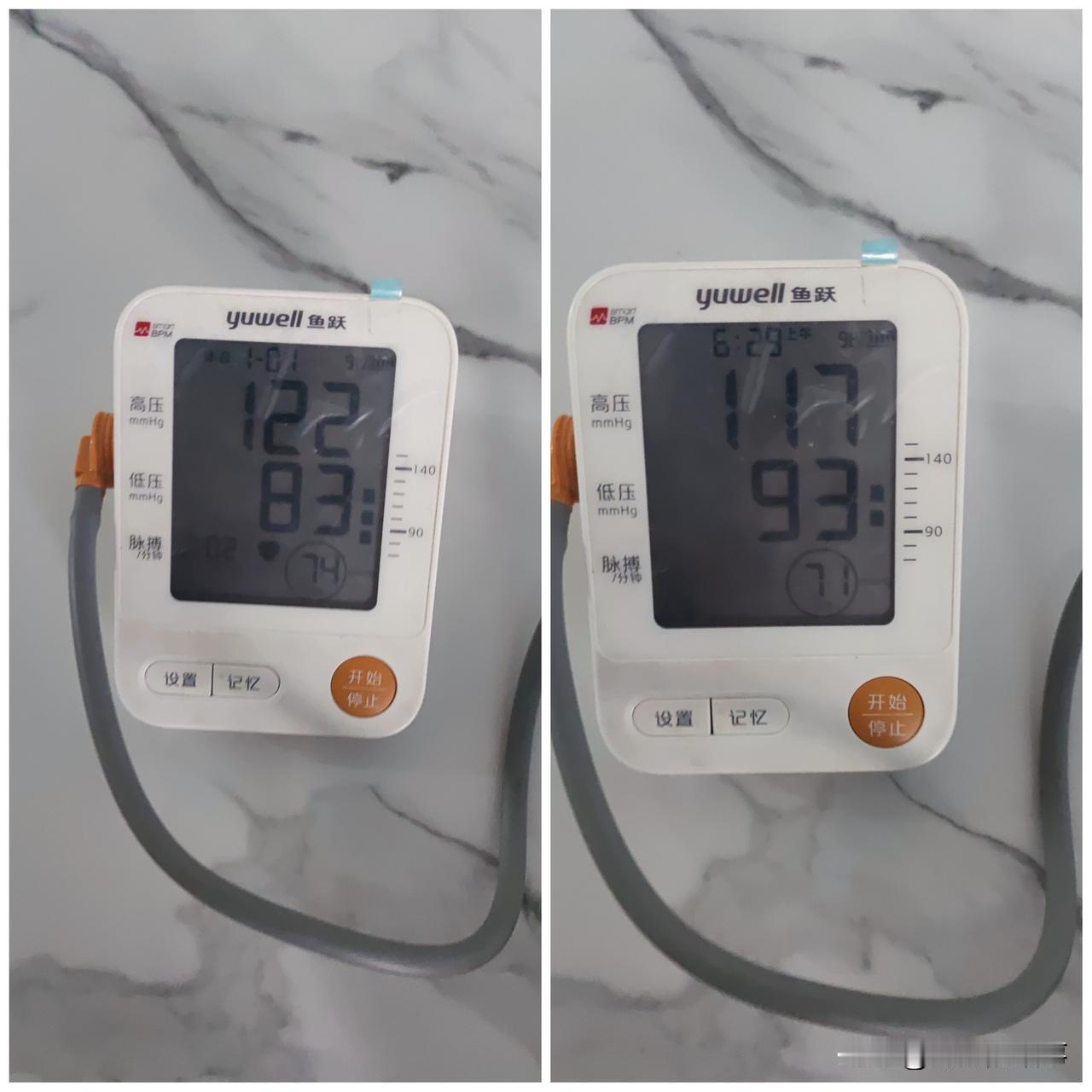 有高血压的朋友们，咨询大家一个问题啊，为啥每次测量左臂和右臂低压相差10呢，高压