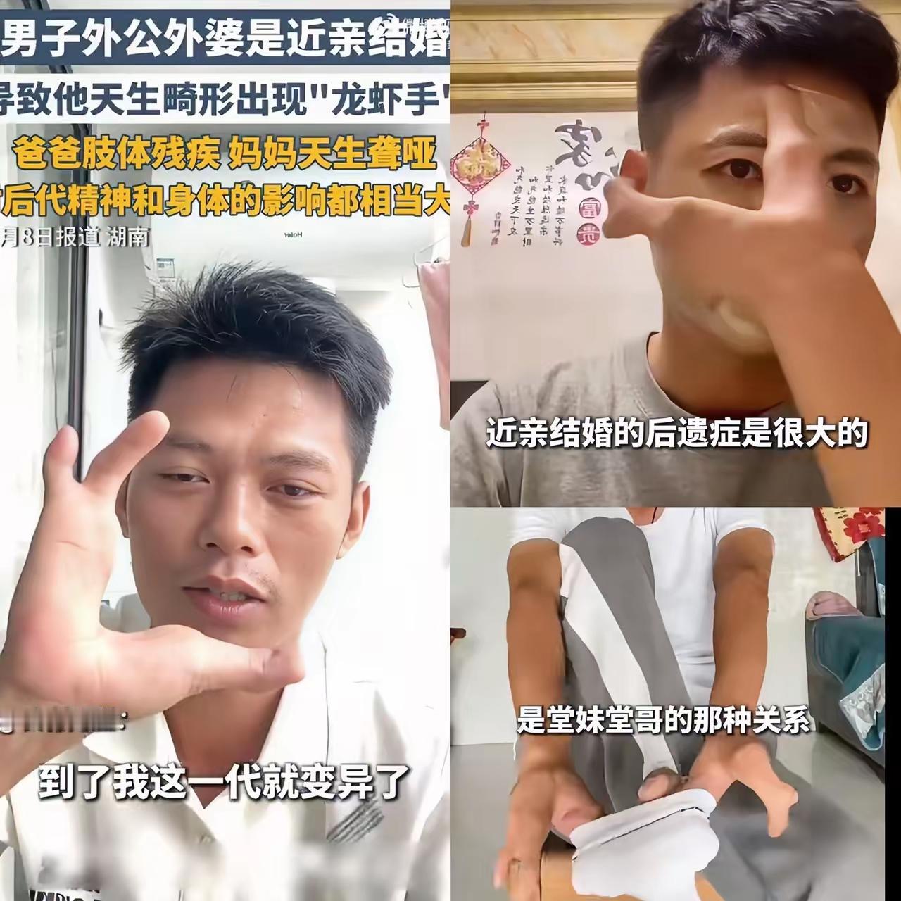 真是疯了
都这样了还要结婚生子！
湖南一90后男子因外公外婆近亲结婚，导致家族连
