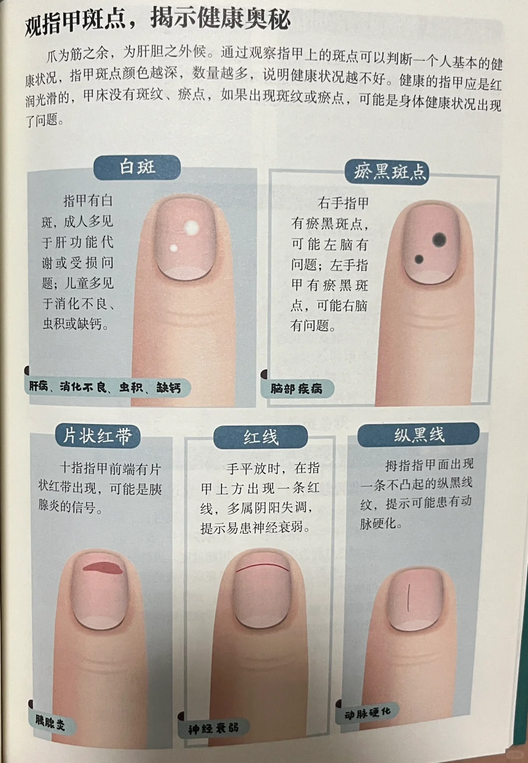 中医之看指甲识健康