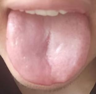 明明体质偏虚，为何心神杂念反而旺盛？读懂上实下虚，对症调养稳状态






有