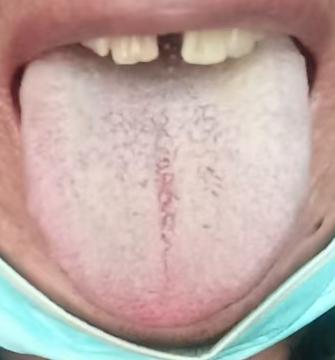 起而不坚，敏感过快？中医点名根源：控制力差，问题在心不在肾






很多男同