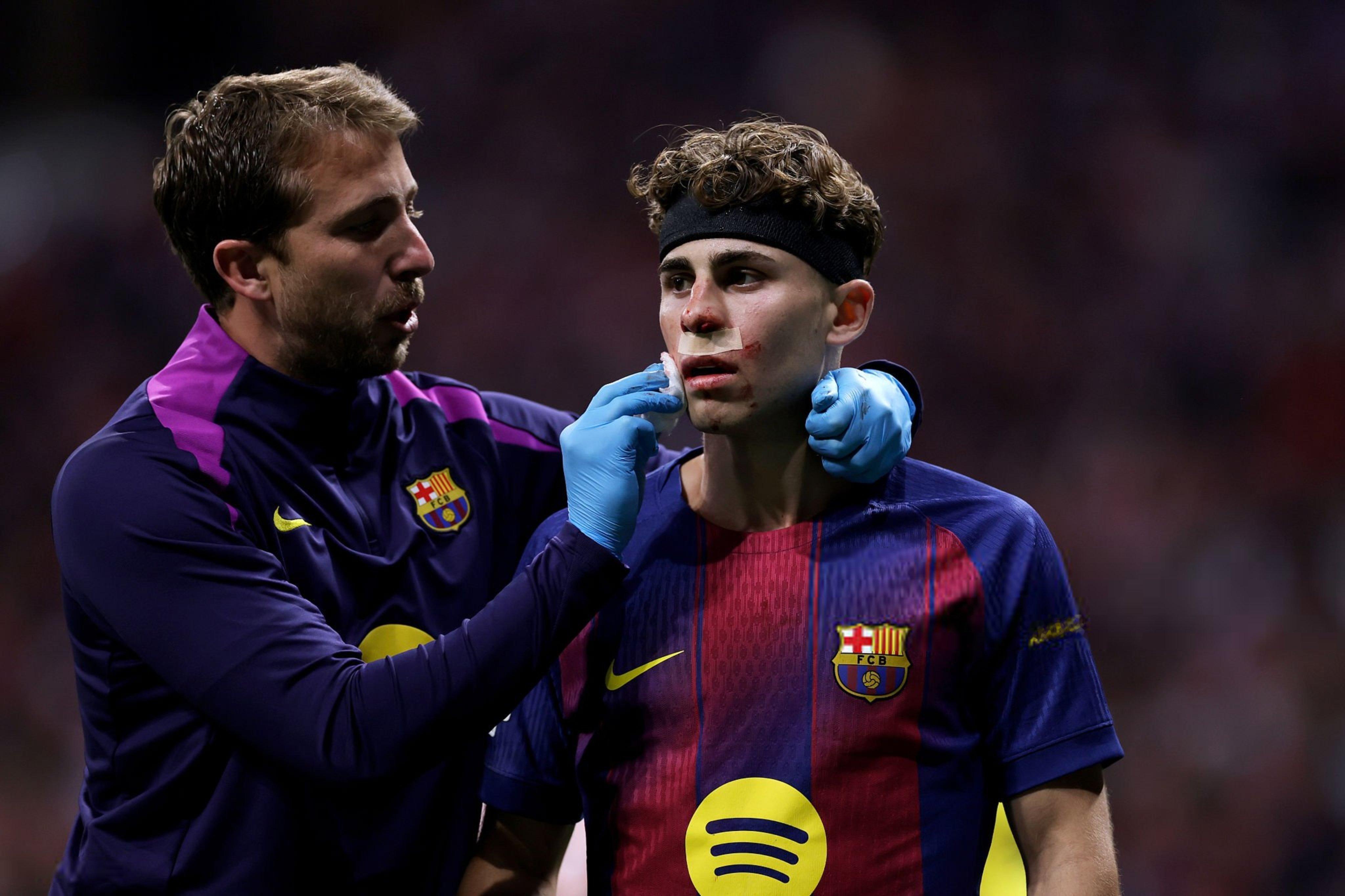 鼻子下面的费尔明欧冠联赛马竞vs巴萨巴萨