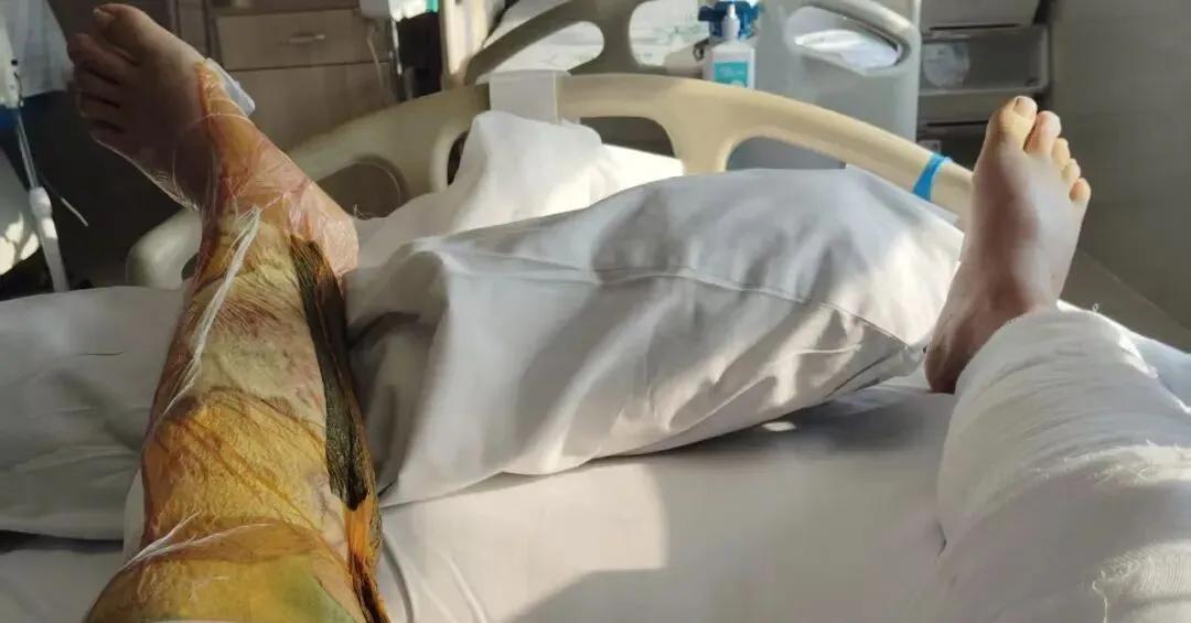 上海闵行，一名男子自助加油时，操作不当导致汽油洒在裤子上。男子没当回事，觉得晾晾