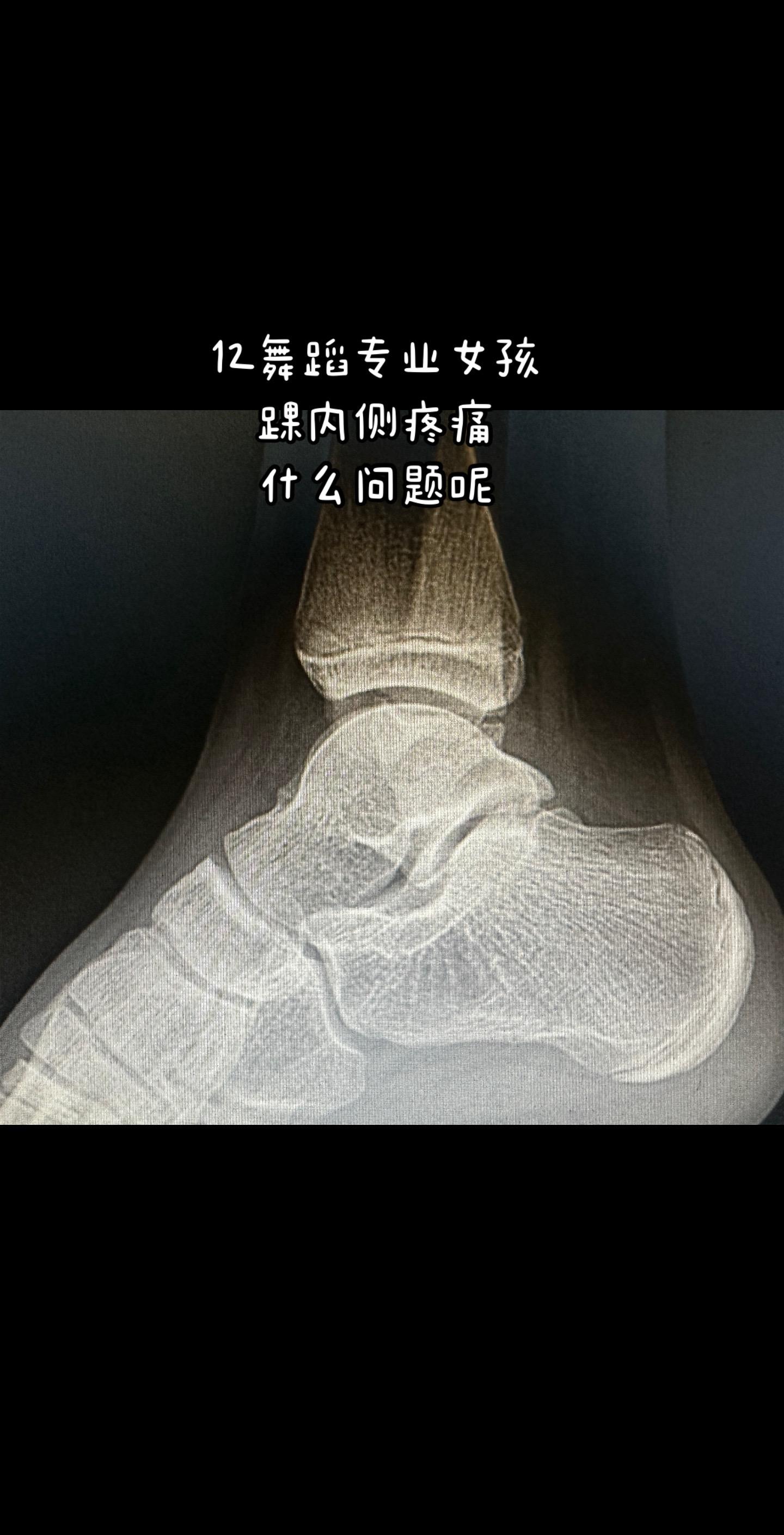 大家一起来诊断。门诊案例看看什么问题运动康复