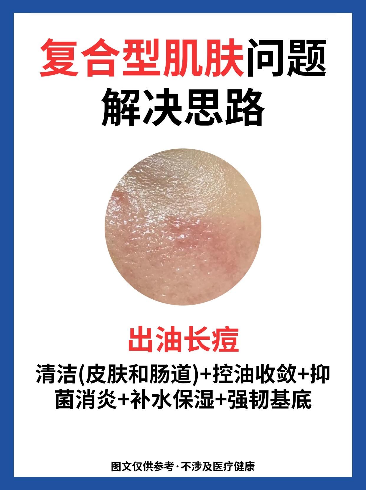 不同肌肤问题解决思路。