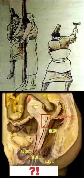 幽闭之刑！[发怒]
过去，常用于出轨女人！

古代有一种刑罚，可让女性失去生育能