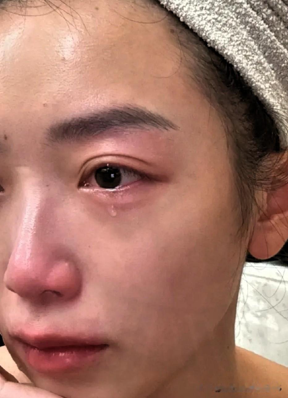 尿路感染的原因是什么？有位女同事和她男朋友同居2年了，期间她平均5天就要吃一次尿