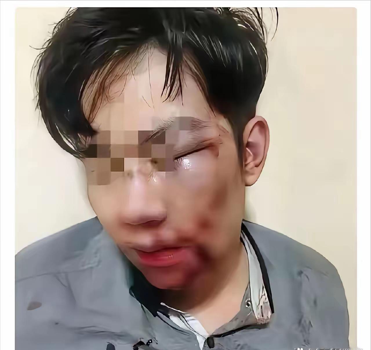 女子远嫁，老公觉得她娘家远经常家暴她。
春节到了，很多在外打工的人都陆陆续续回到