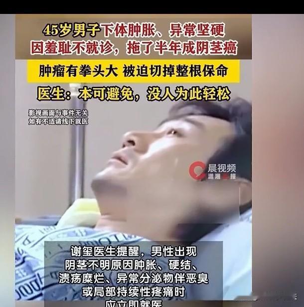 死要面子毁终身！浙江杭州，45岁男子私密部位不适，尤其排尿时刺痛严重，可他这人很