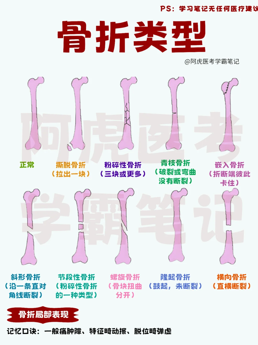 医学生笔记📒｜骨折类型👆