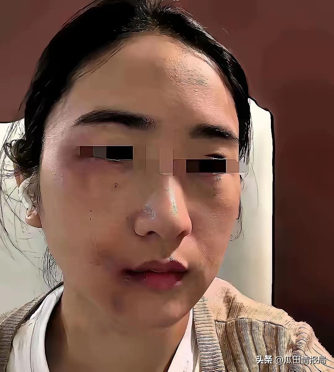家暴我的丈夫肝癌晚期，要70万换肝，我选择不救。

消息传开，亲戚们炸了锅，说我