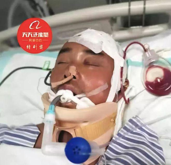 善恶终有报！河南大哥为救陌生小孩重伤昏迷，醒来后问：孩子没事吧？随即变成植物人！