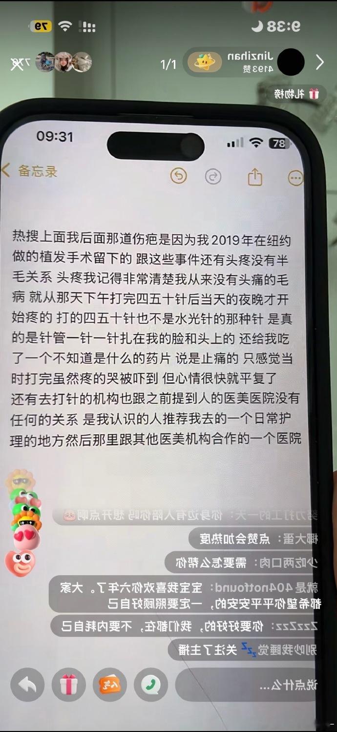 金子涵说后脑勺的疤是植发留下的金子涵回应后脑勺的伤疤 金子涵说后脑勺的疤是植发留
