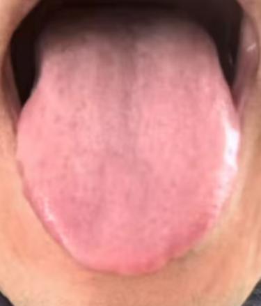 常年畏寒湿气重，多是脾肾不足，这样调理更稳妥







用中医的方法调理身体